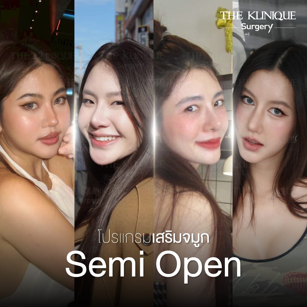 การดูแลหลัง เสริมจมูก Semi Open