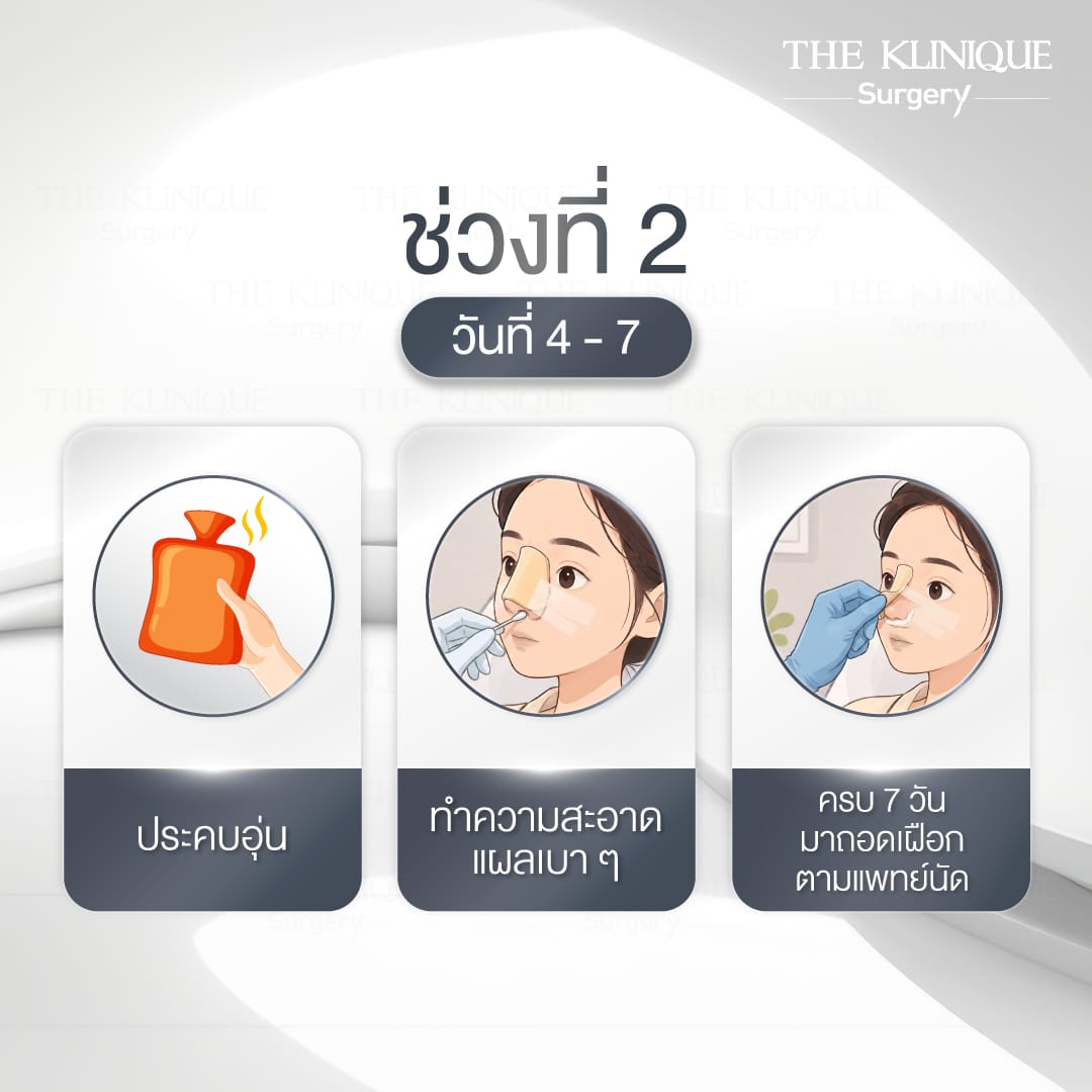 การดูแลหลัง เสริมจมูก Semi Open