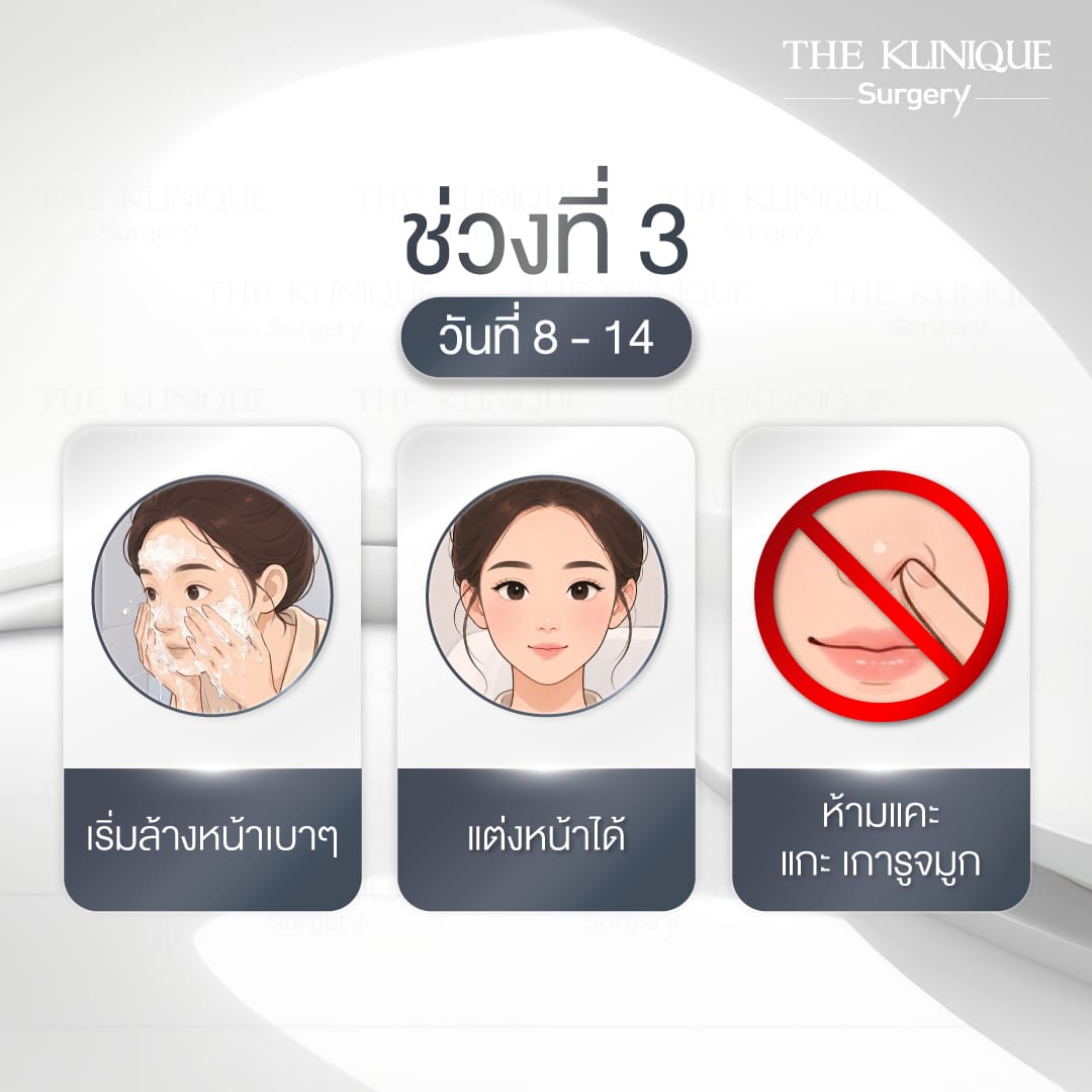 การดูแลหลัง เสริมจมูก Semi Open