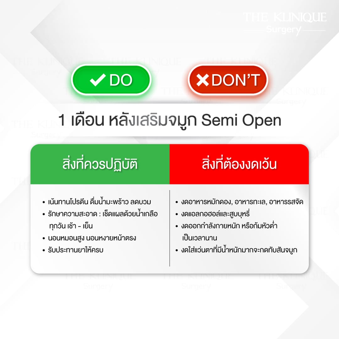 การดูแลหลัง เสริมจมูก Semi Open