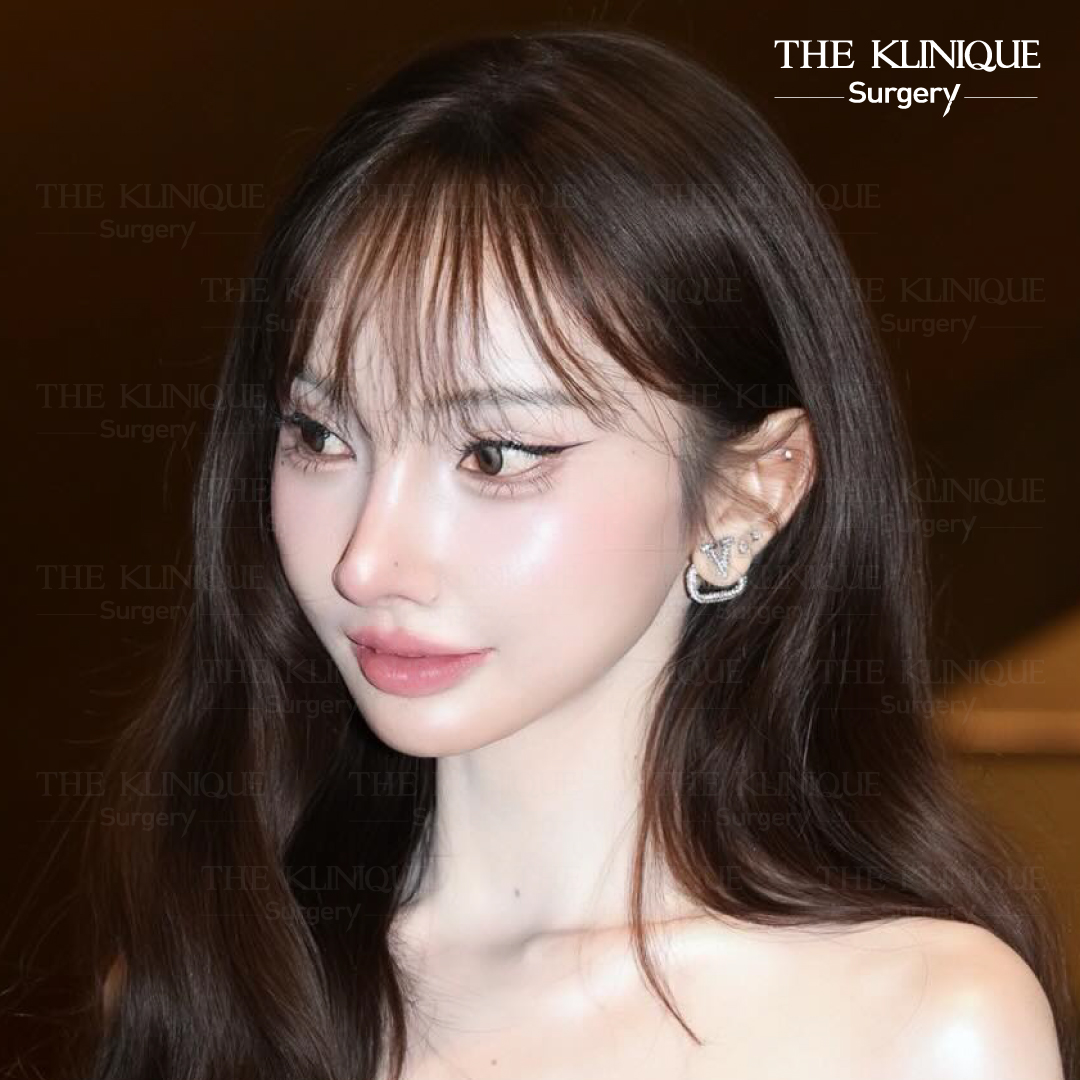 รีวิวเสริมจมูกโอเพ่น หมอฮง