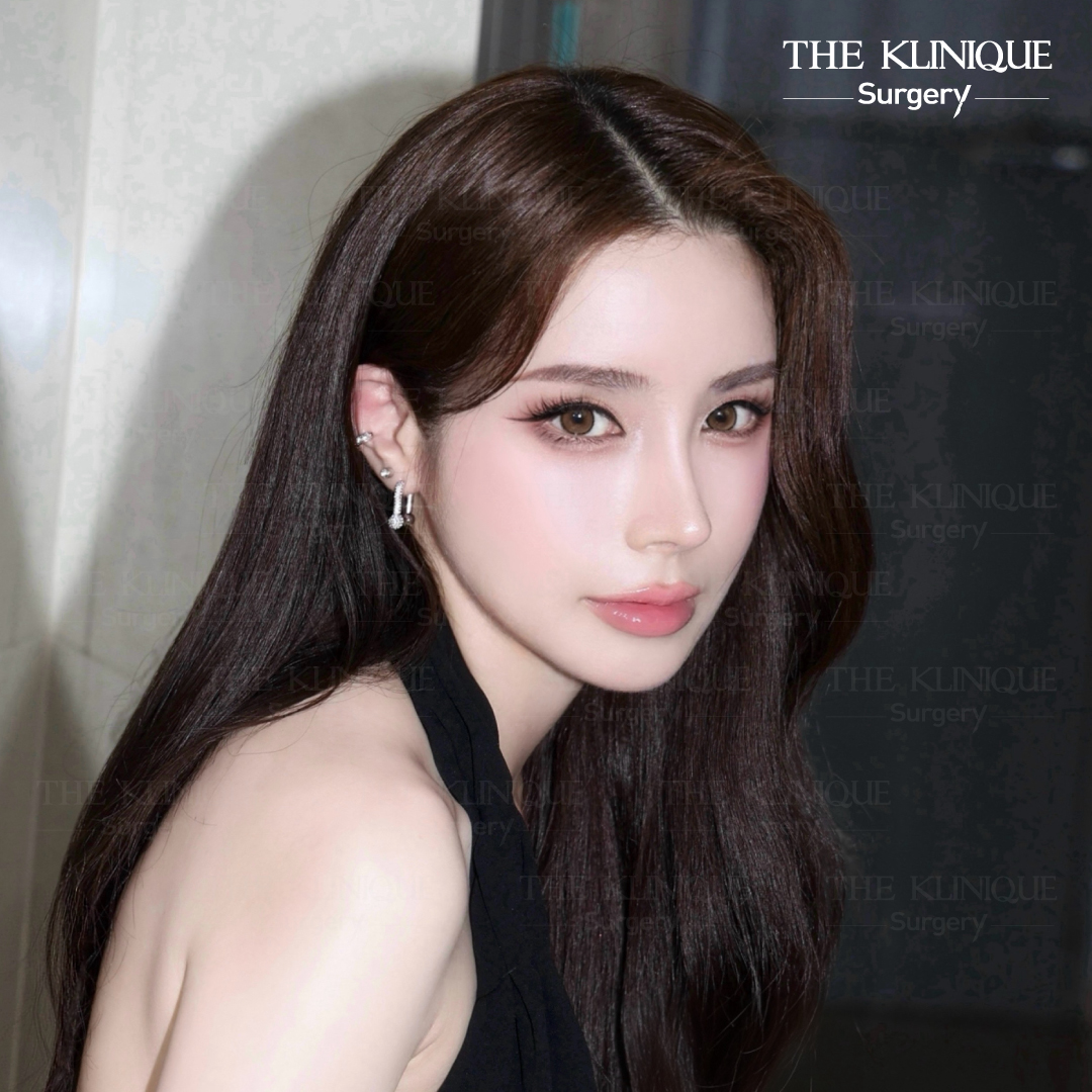 รีวิวเสริมจมูกโอเพ่น หมอฮง