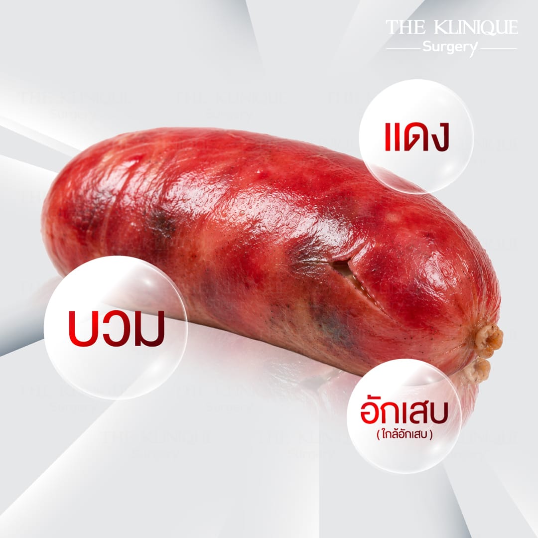 สารอันตรายต่ออวัยวะเพศชาย