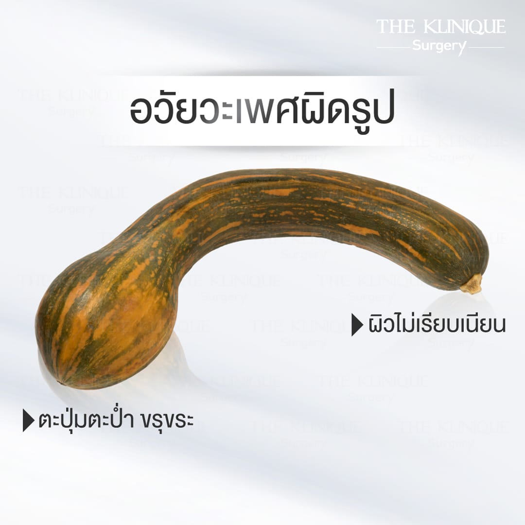 สารอันตรายต่ออวัยวะเพศชาย