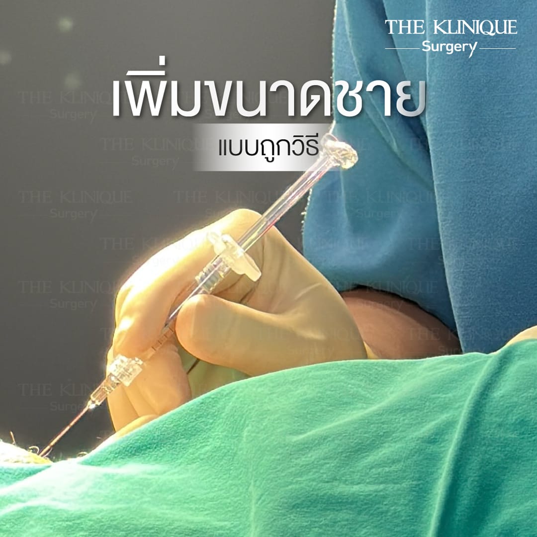เพิ่มขนาดน้องชาย