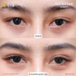 รีวิวตาสองชั้น