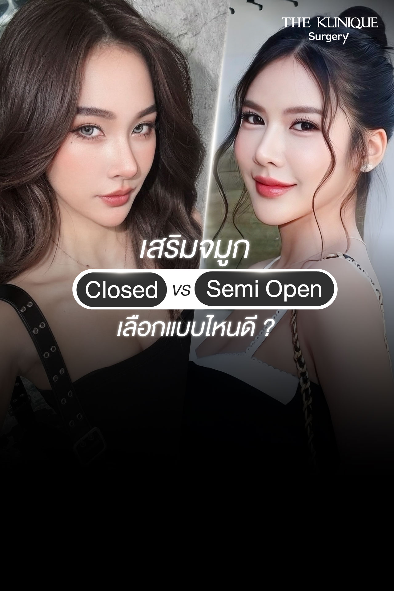 รีวิวเสริมจมูกเทคนิค Semi Open และ Closed ปรับทรงสวย
