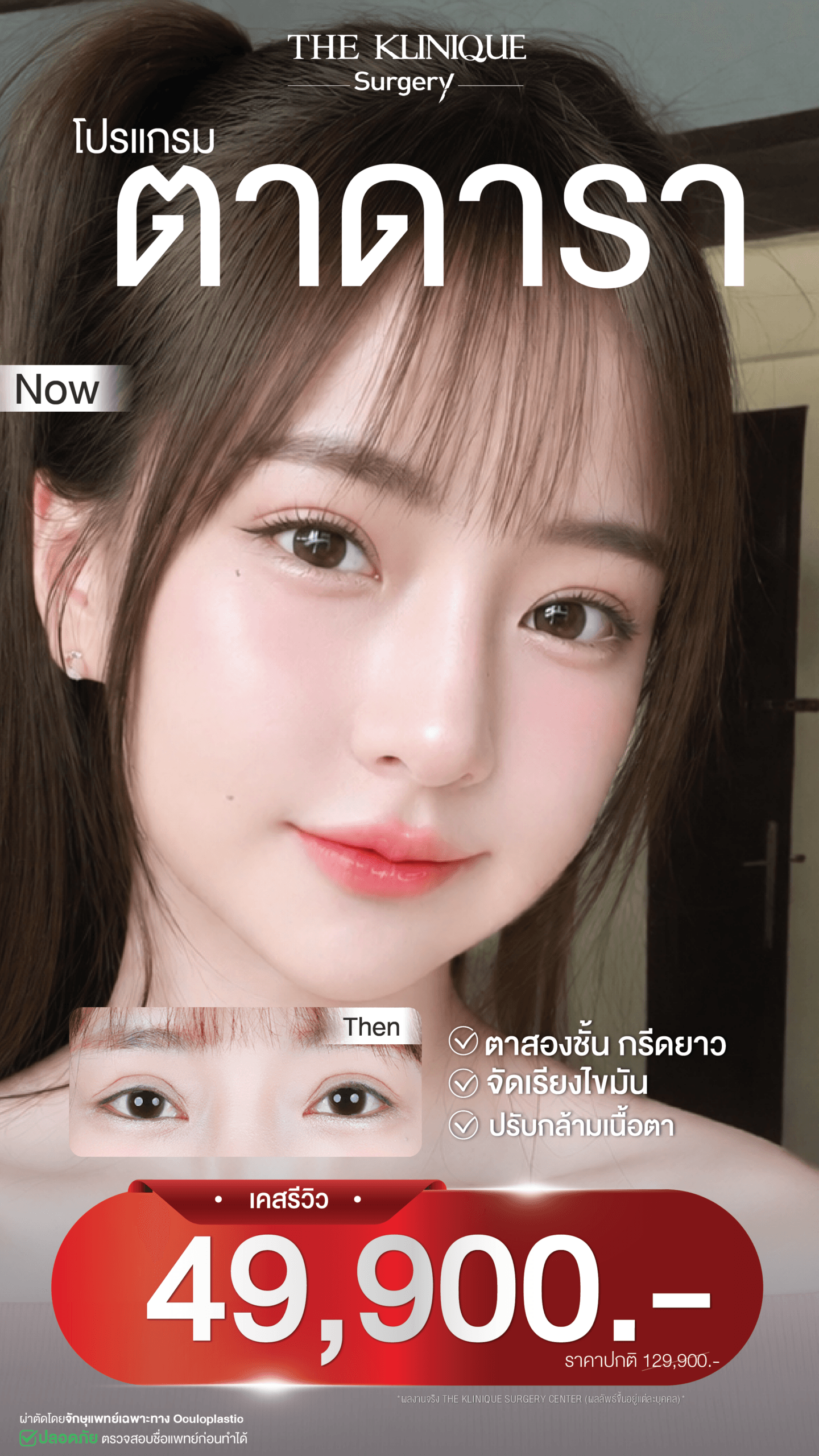 ตาสองชั้น” style=