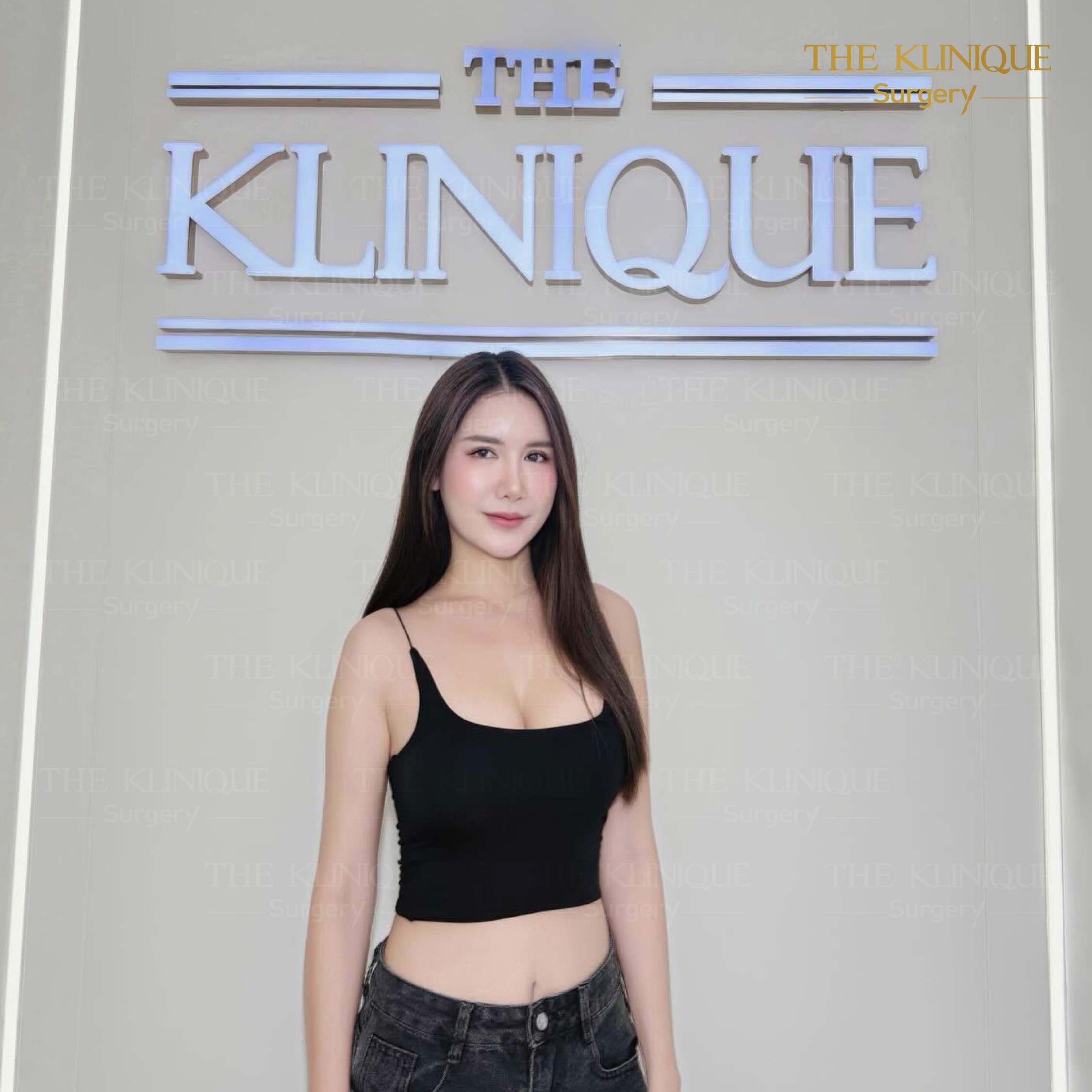 รีวิว ดูดไขมัน Sexyline หน้าท้อง