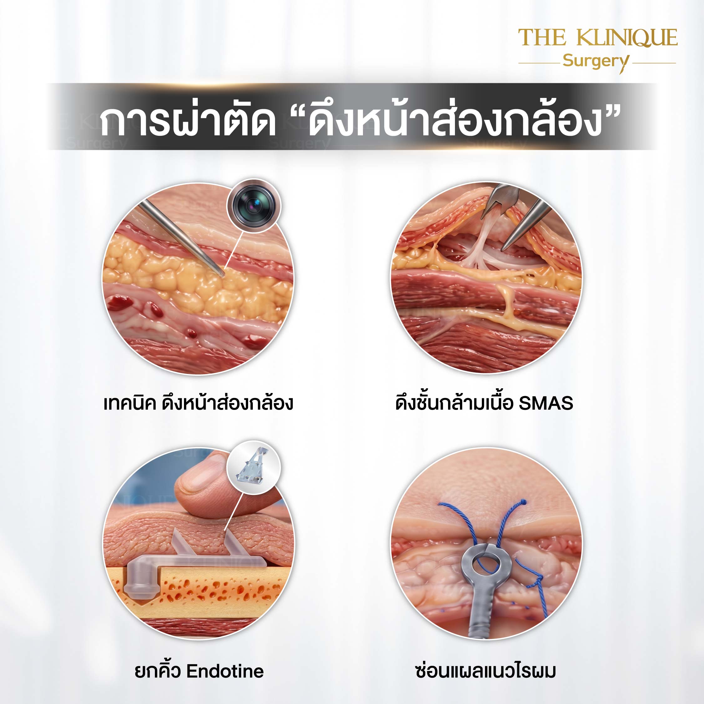 ยกคิ้ว Edotine
