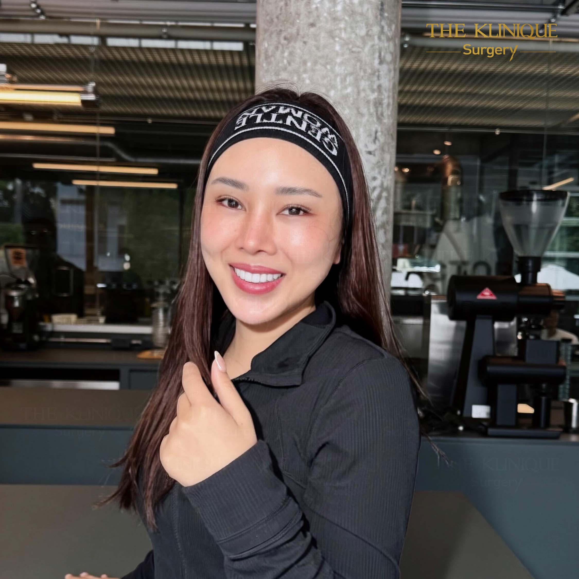 รีวิวดึงหน้า Facelift & ยกคิ้ว Edotine