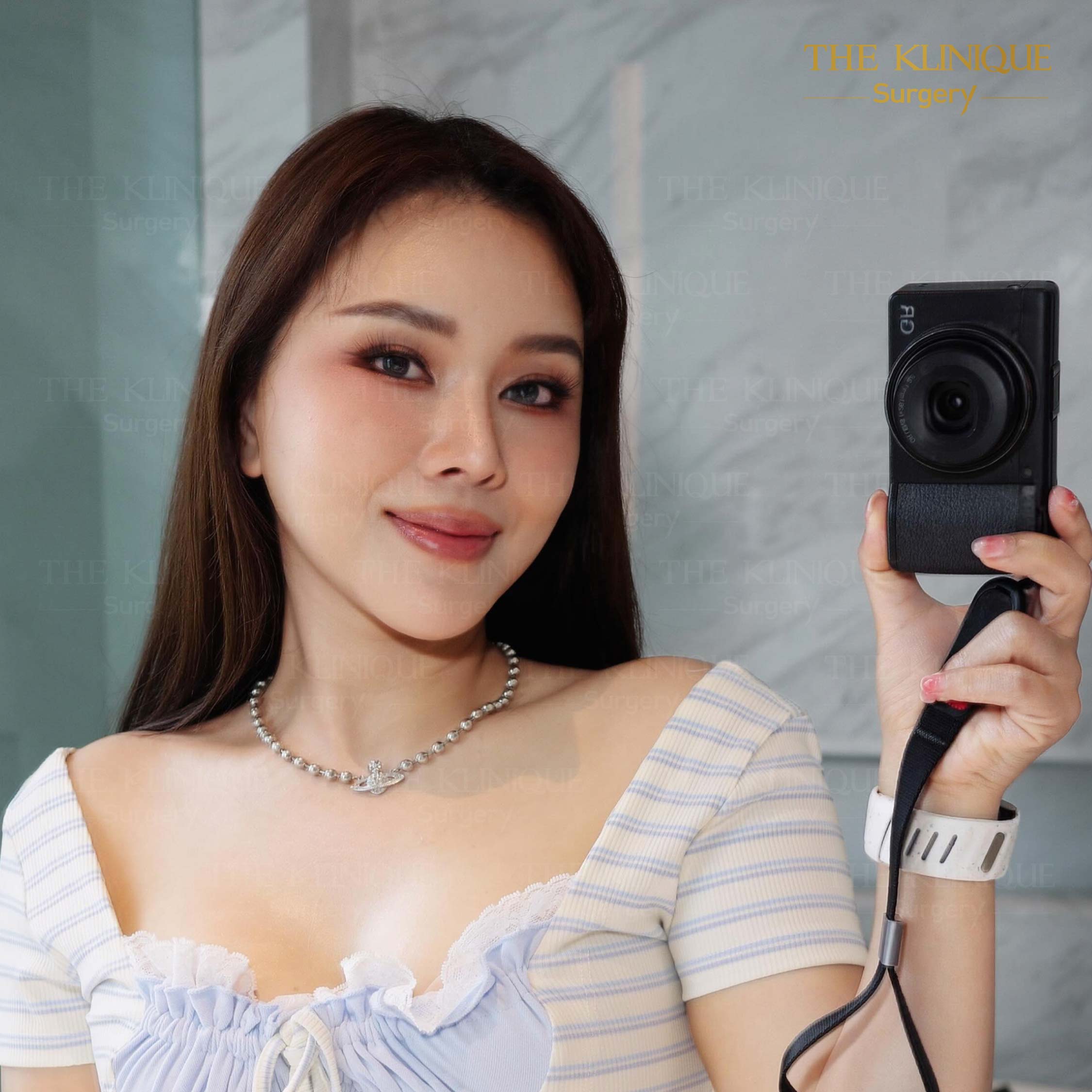 รีวิวดึงหน้า Facelift & ยกคิ้ว Edotine
