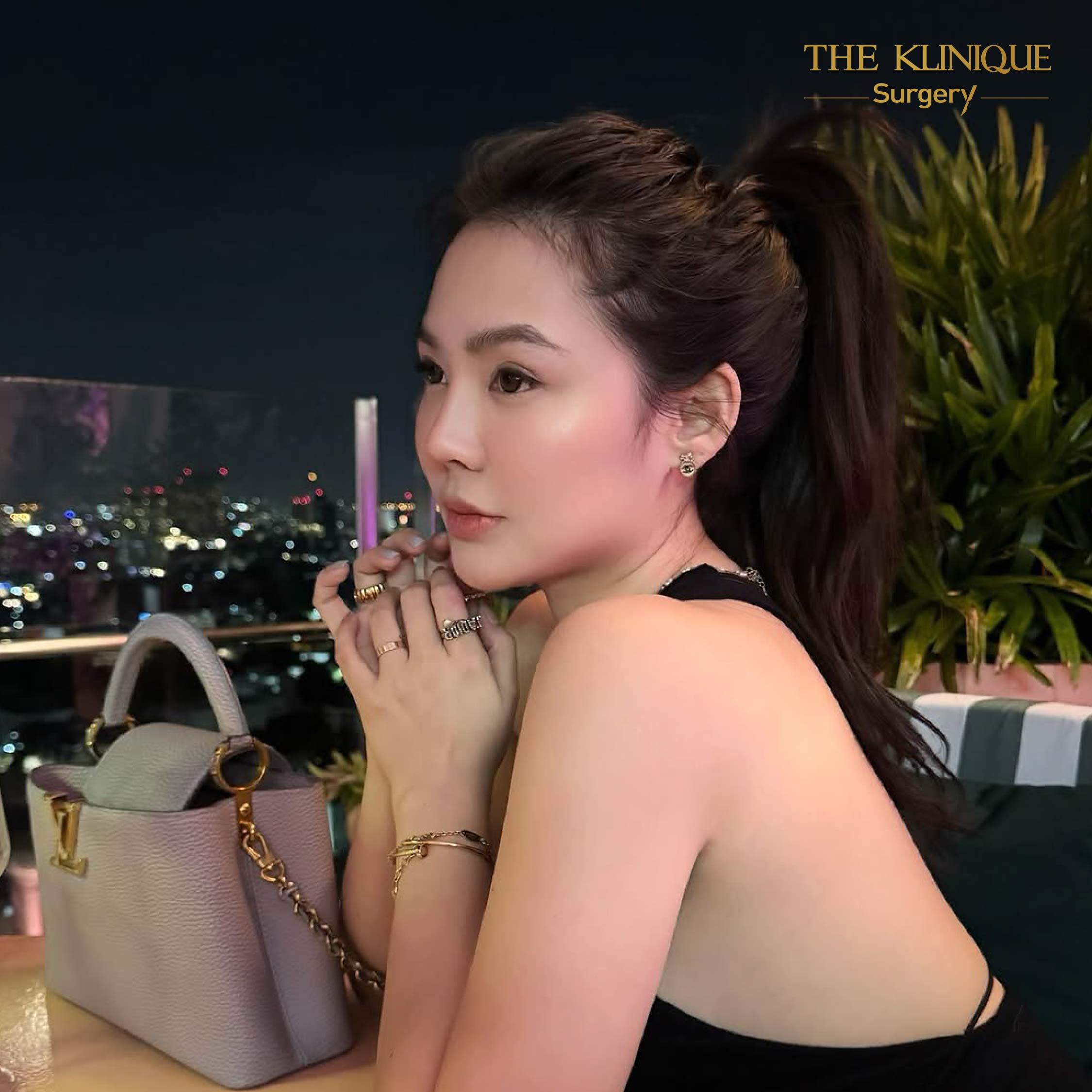 รีวิว ดูดไขมัน (Liposuction) แขน หน้าท้อง