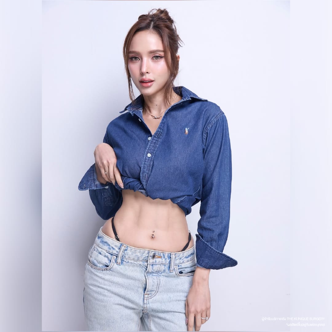 รีวิว ดูดไขมันหน้าท้อง