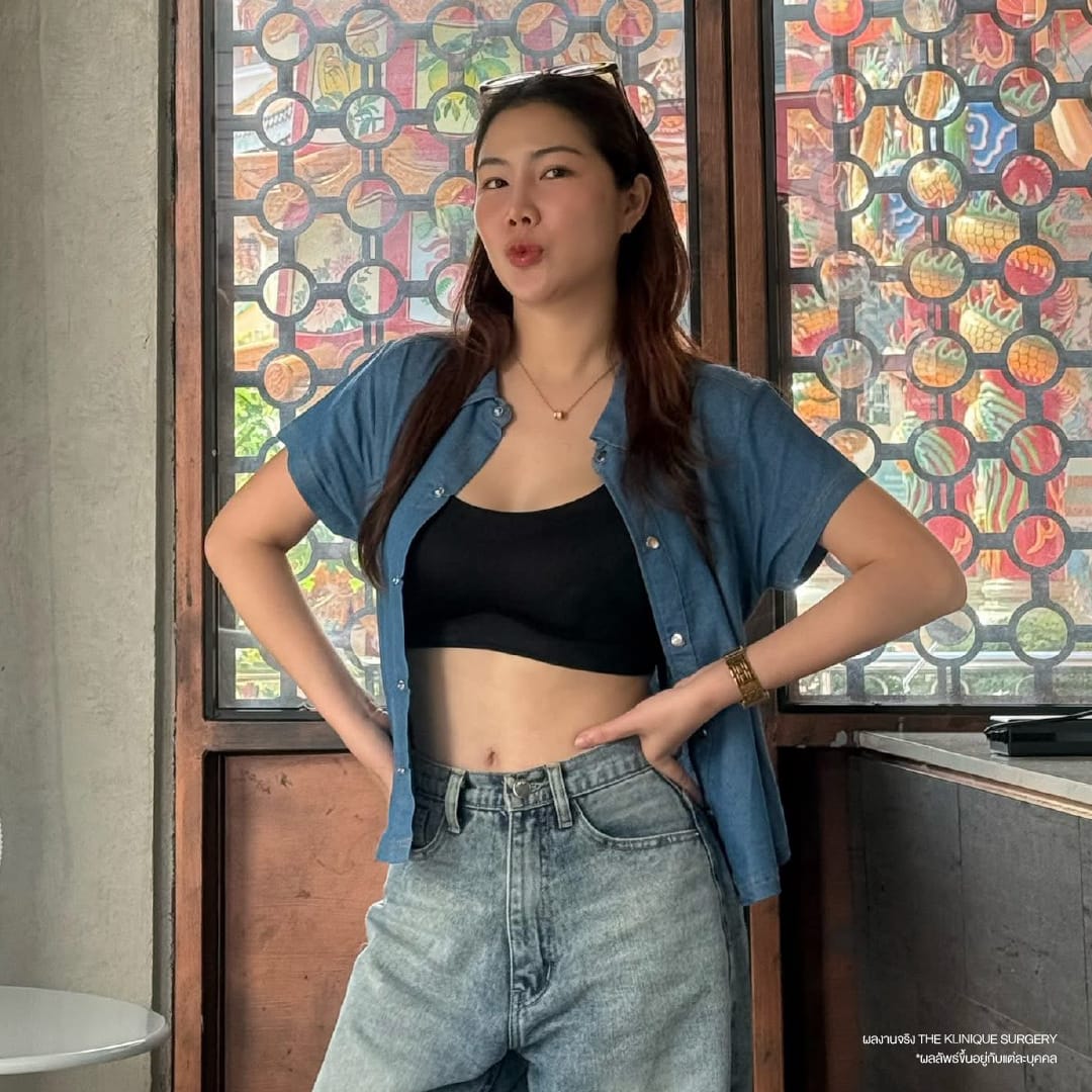 รีวิว ดูดไขมัน