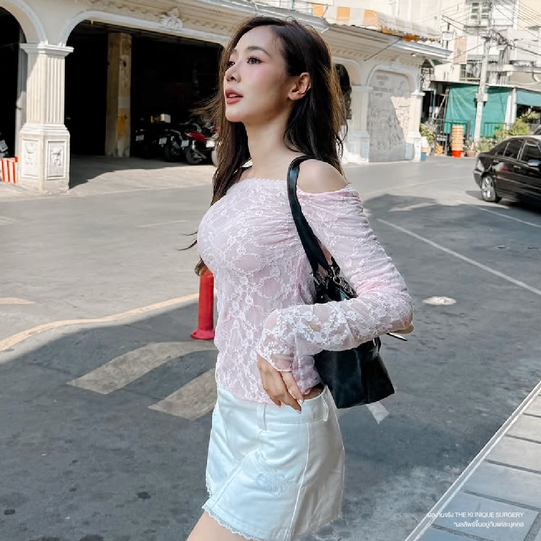 ดูดไขมันดารา