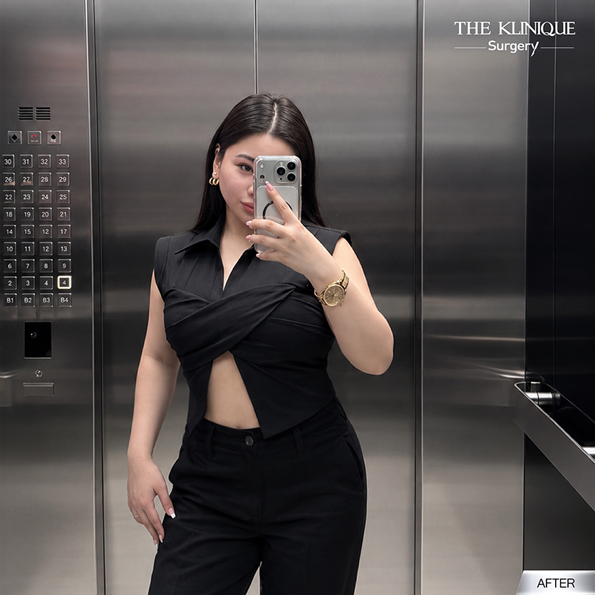 รีวิวดูดไขมัน หมอจอง