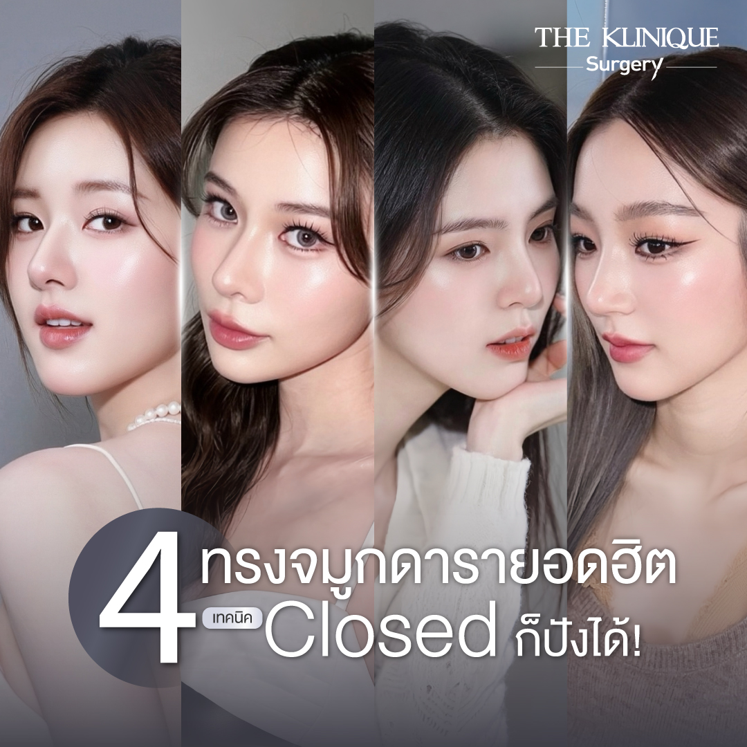 รีวิวทรงจมูกดารายอดฮิต