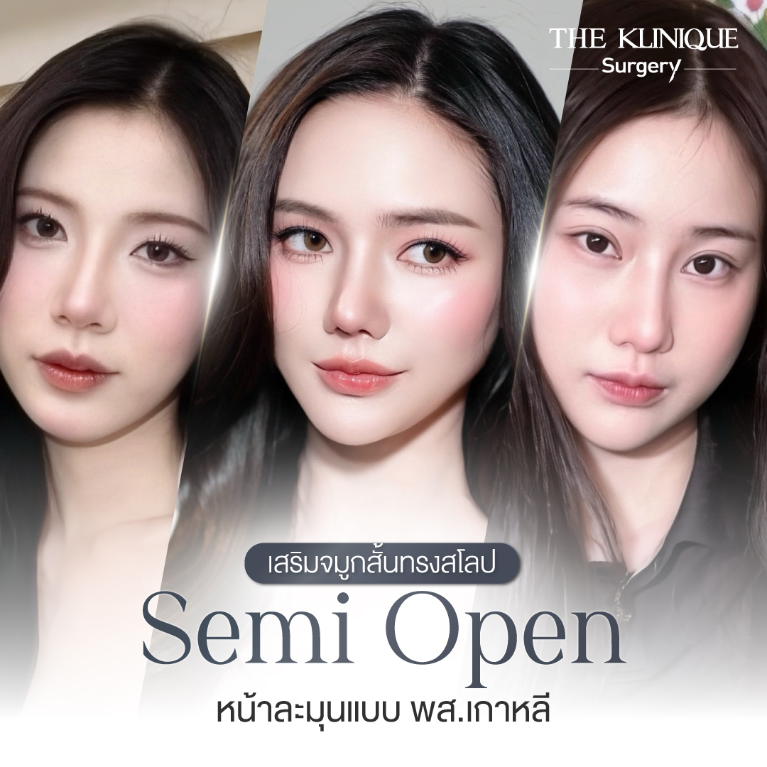 เสริมจมูกสั้นทรงสโลป Semi Open