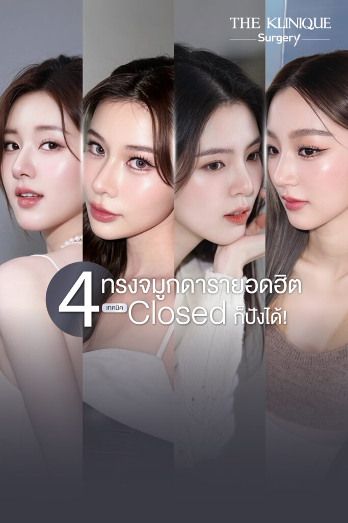รีวิวทรงจมูกดารายอดฮิต