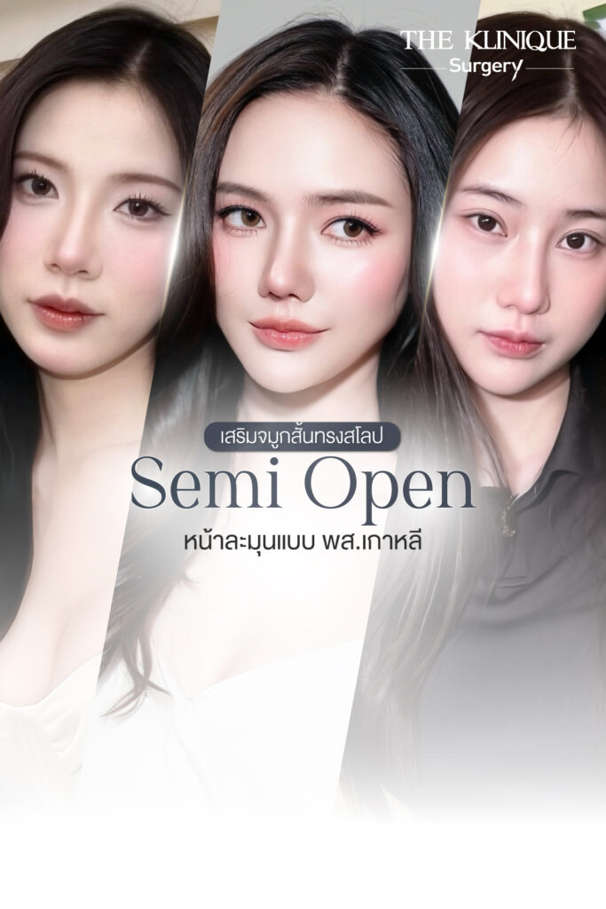 เสริมจมูกสั้นทรงสโลป Semi Open