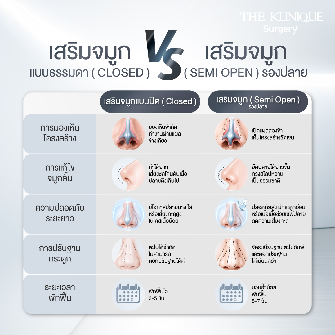 รีวิวเสริมจมูก Semi Open