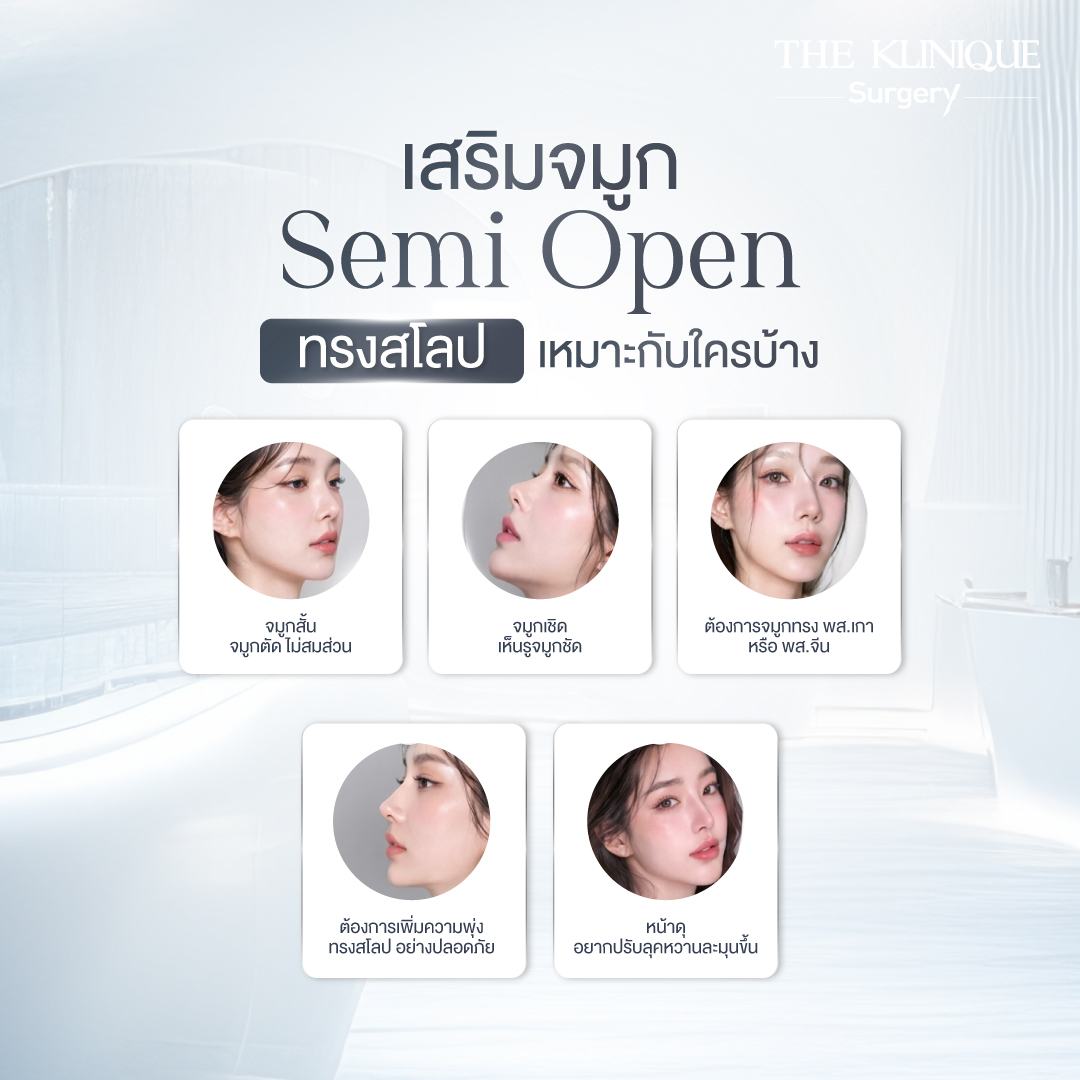 รีวิวเสริมจมูก Semi Open