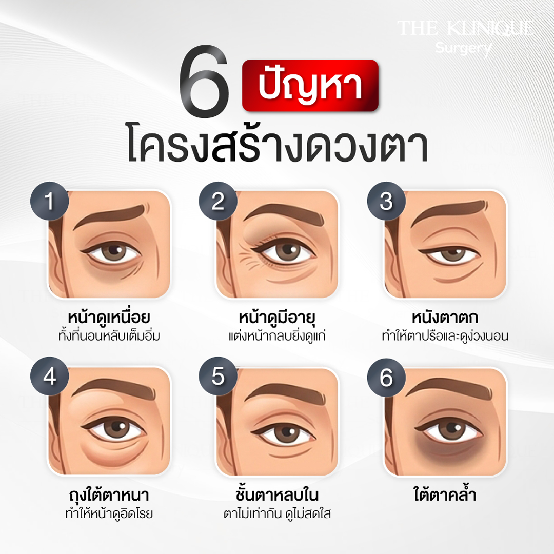 โครงสร้างตา