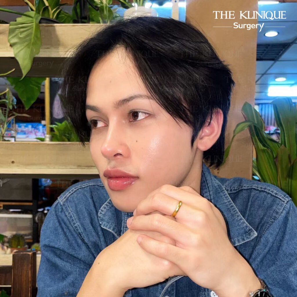 รีวิวทรงจมูกดารายอดฮิต