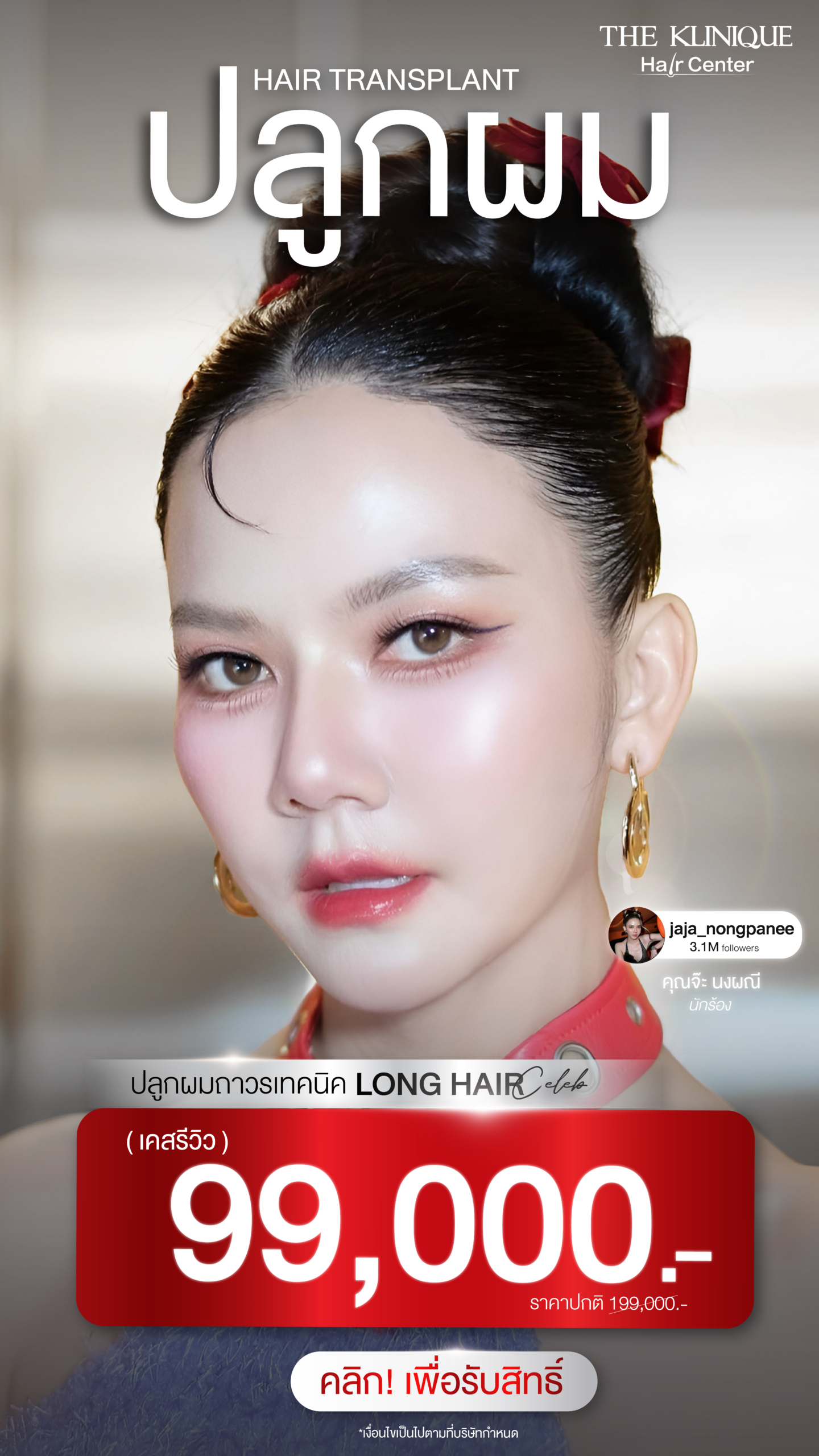 ปลูกผมถาวร