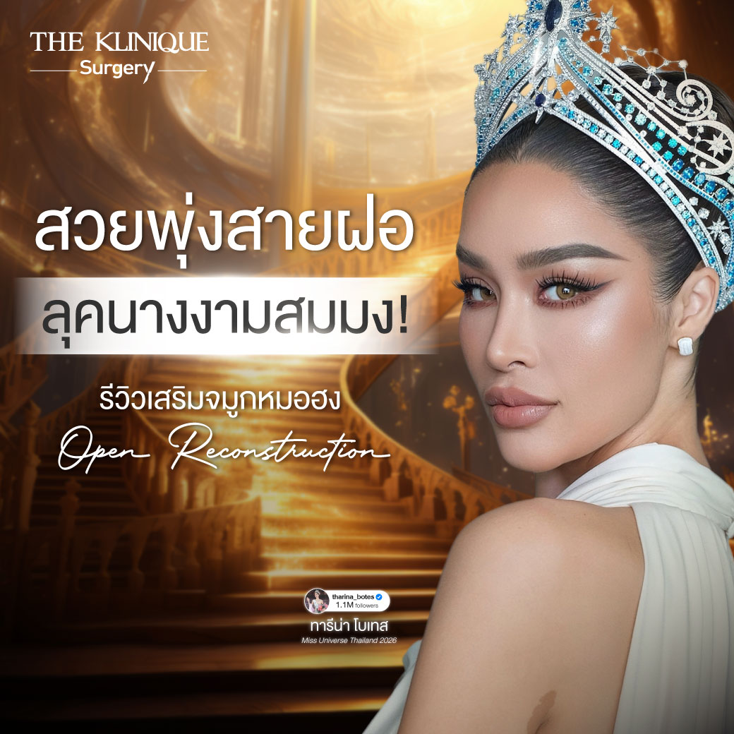 ทารีน่า Miss Grand All Star 2026 รีวิวเสริมจมูกโอเพ่น ทรงพุ่งสายฝอ เทคนิค Open Reconstruction แก้ไขโครงสร้างด้วยกระดูกอ่อนซี่โครง โดยคุณหมอฮง ศัลยแพทย์ตกแต่งเฉพาะทาง THE KLINIQUE Surgery
