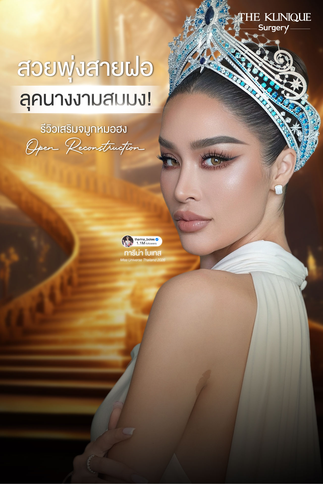 ทารีน่า Miss Grand All Star 2026 รีวิวเสริมจมูกโอเพ่น ทรงพุ่งสายฝอ เทคนิค Open Reconstruction แก้ไขโครงสร้างด้วยกระดูกอ่อนซี่โครง โดยคุณหมอฮง ศัลยแพทย์ตกแต่งเฉพาะทาง THE KLINIQUE Surgery