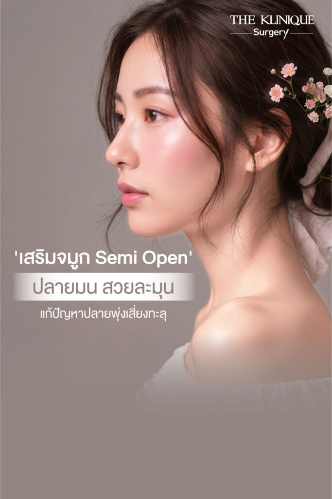 เสริมจมูก Semi Open ปลายมน