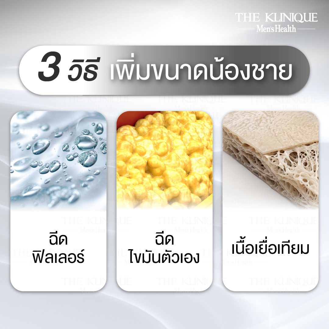 เพิ่มขนาดน้องชาย