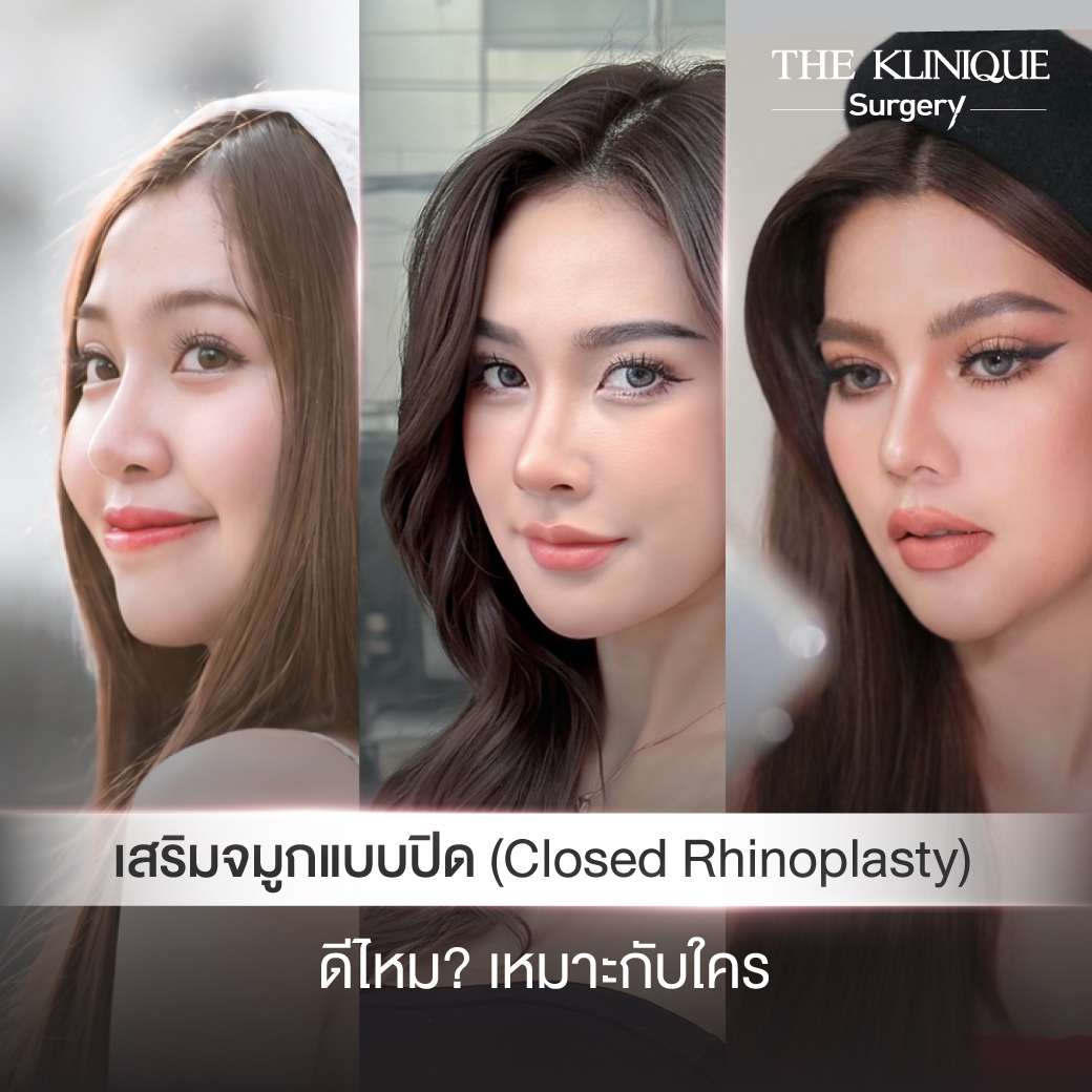เสริมจมูกแบบปิด (Closed)