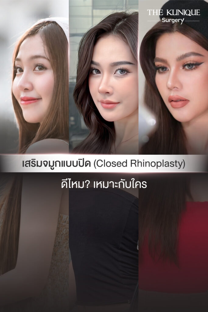 เสริมจมูกแบบปิด (Closed)