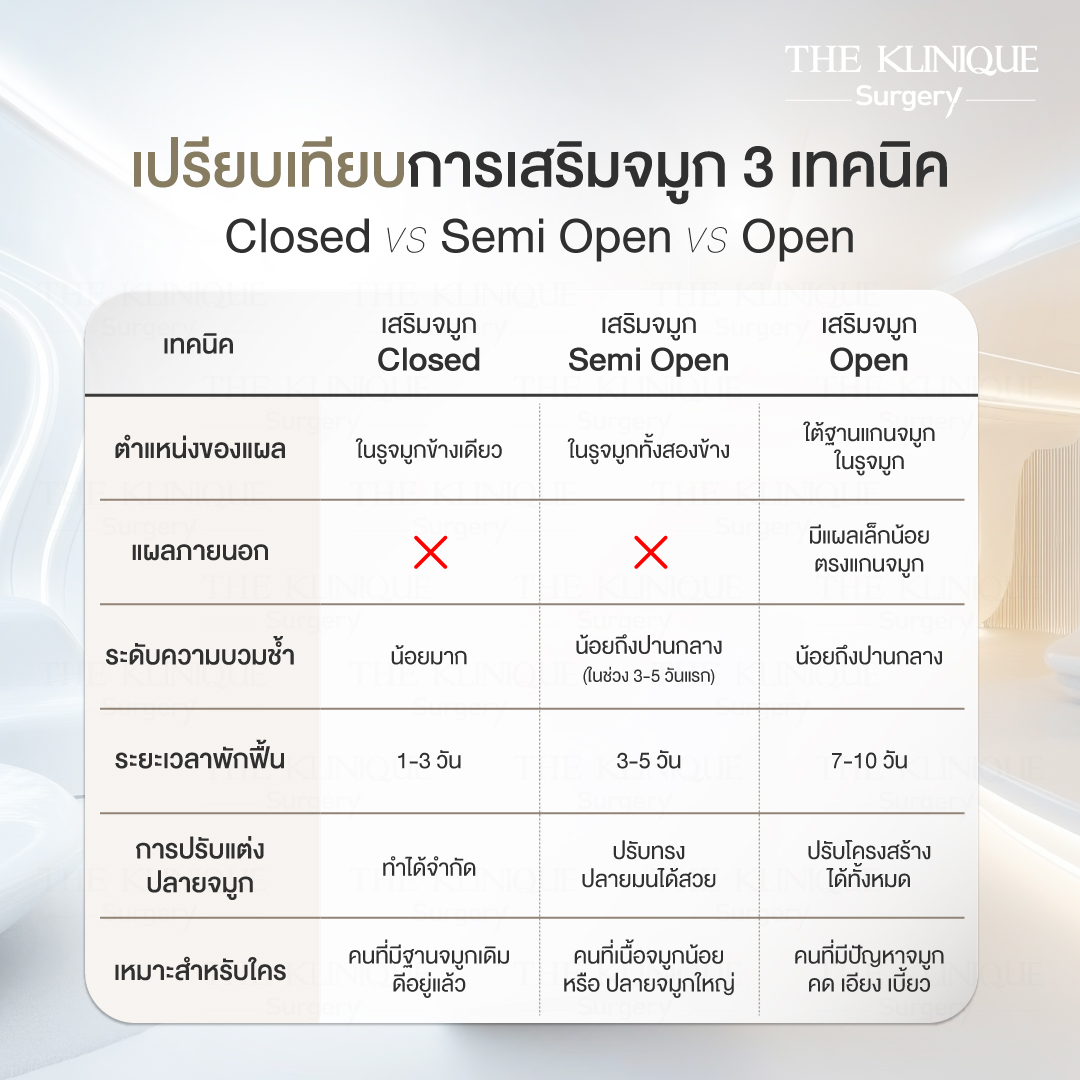 เสริมจมูก Semi Open ปลายมน