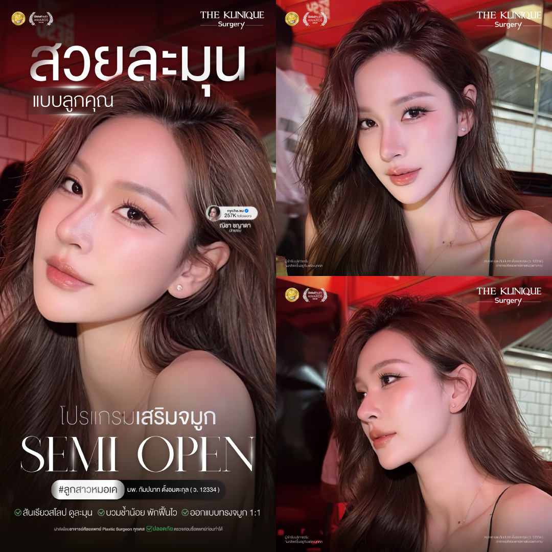 เสริมจมูก Semi Open ปลายมน