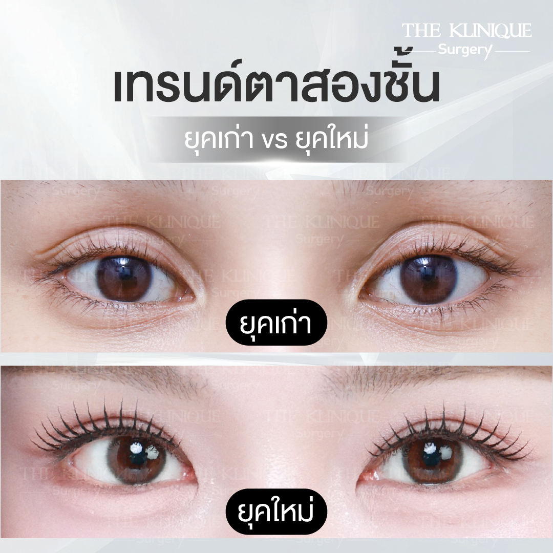 ทำตาสองชั้นธรรมชาติ