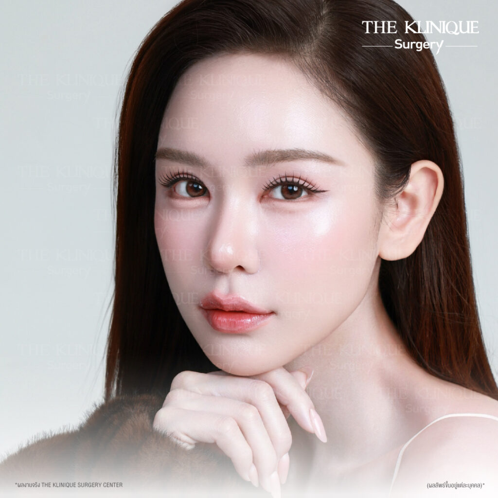รีวิวทำตาสองชั้นธรรมชาติ