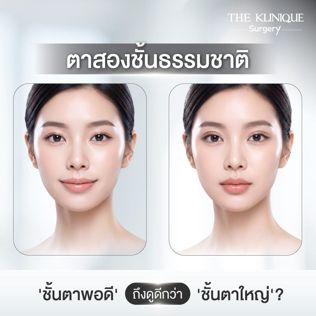 รีวิวทำตาสองชั้นธรรมชาติ
