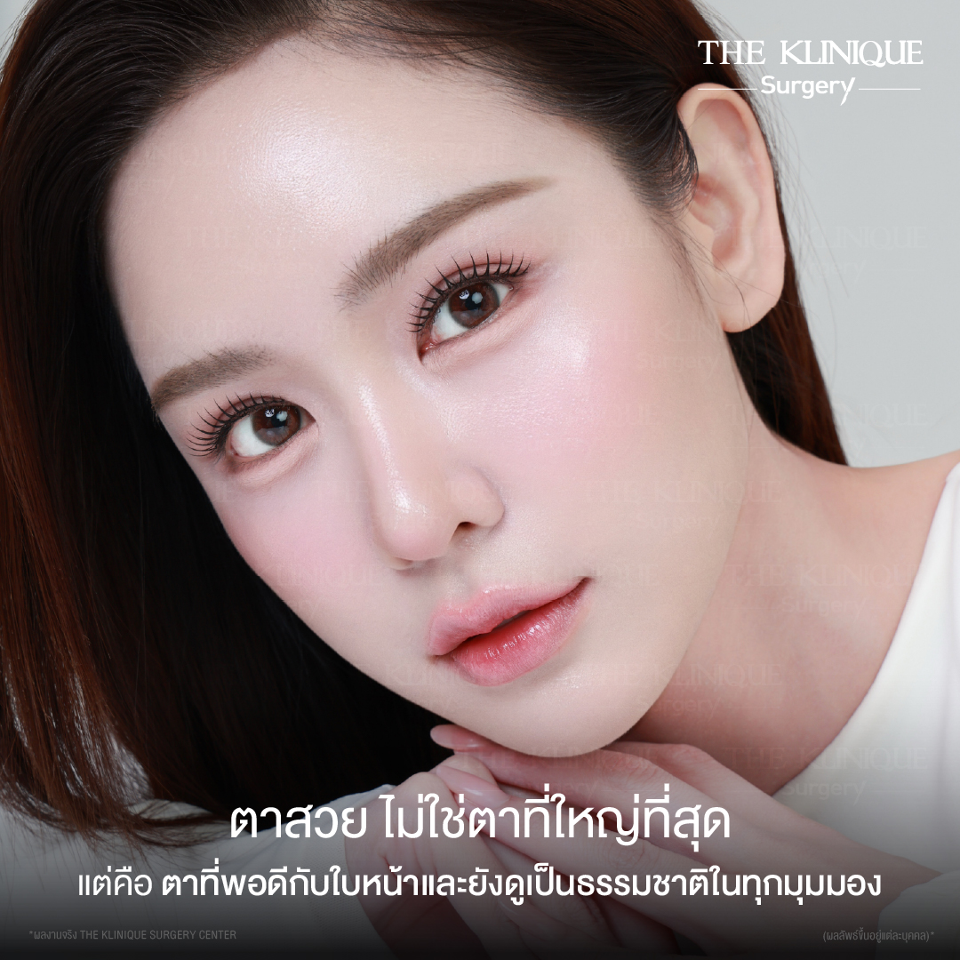 รีวิวทำตาสองชั้นธรรมชาติ