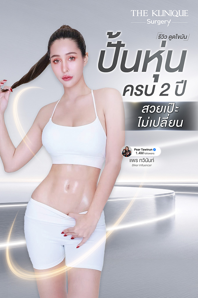 รีวิว ดูดไขมันหน้าท้อง