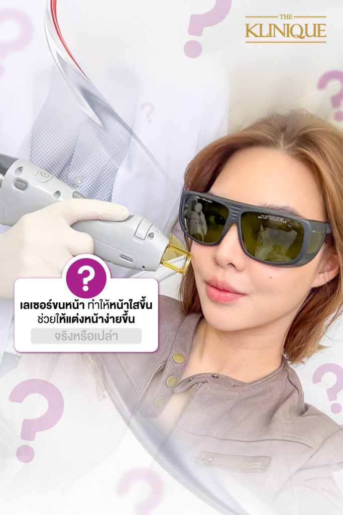 เลเซอร์ขนหน้า เลเซอร์หนวด