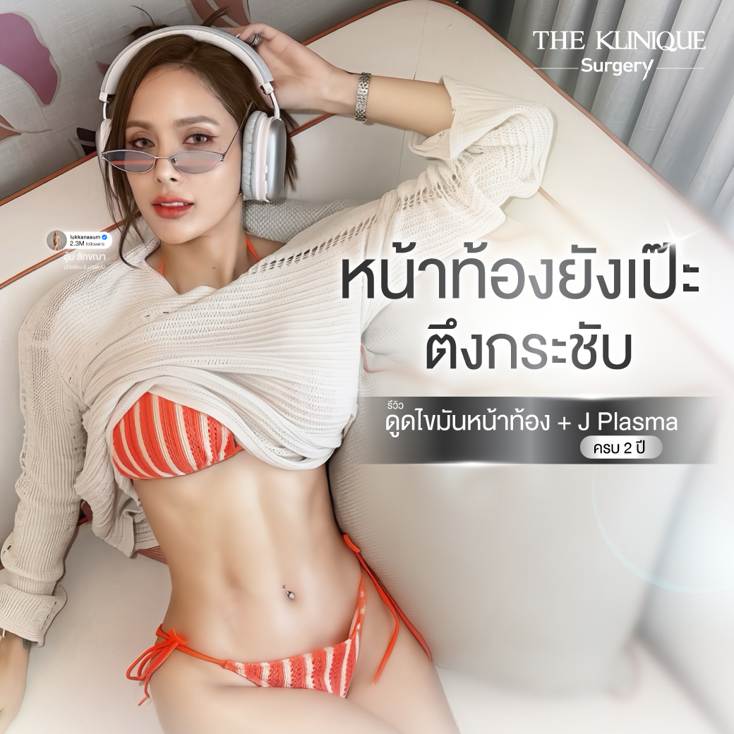 รีวิวดูดไขมันหน้าท้อง