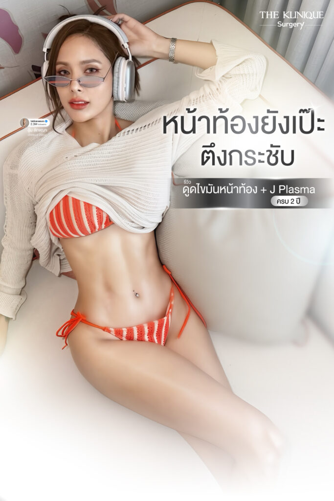 รีวิวดูดไขมันหน้าท้อง
