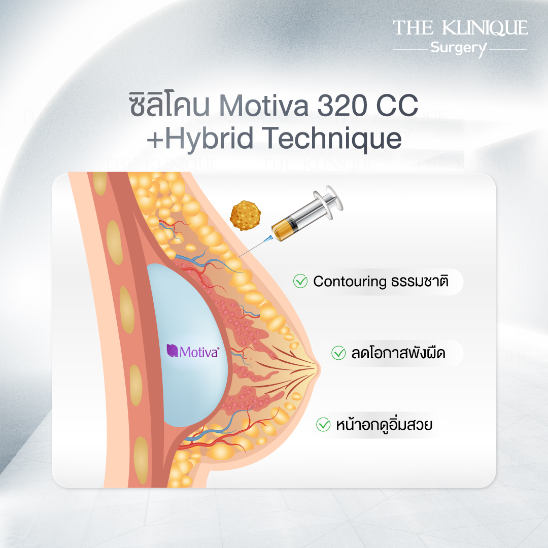 รีวิวแก้หน้าอก
