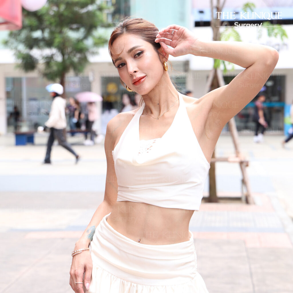อุ้ม ดูดไขมันหน้าท้อง