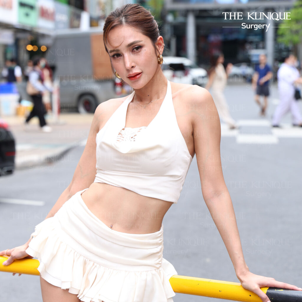 อุ้ม ดูดไขมันหน้าท้อง